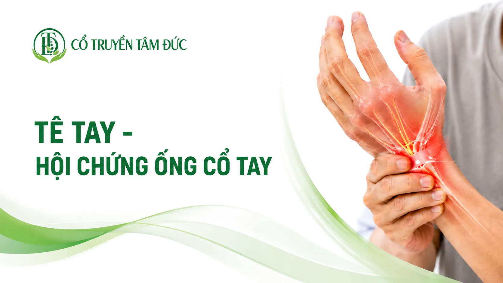 Tê tay do hội chứng ống cổ tay: Dấu hiệu, nguyên nhân và cách điều trị