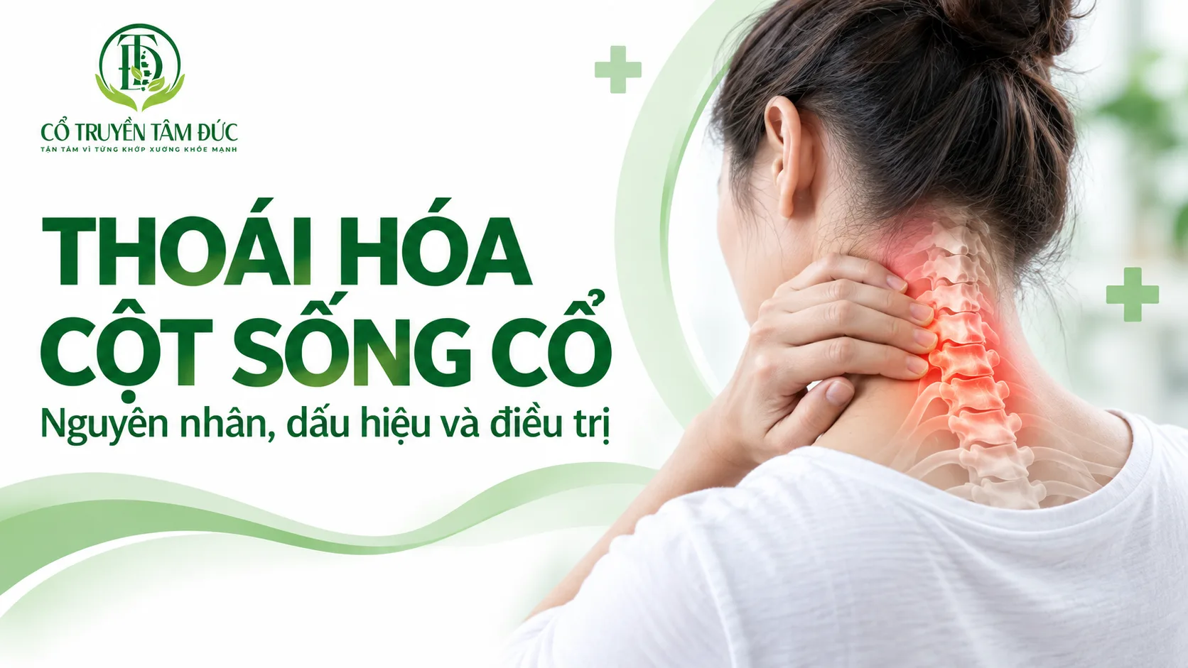 Thoái hóa cột sống cổ: Nguyên nhân, dấu hiệu, chẩn đoán và cách điều trị